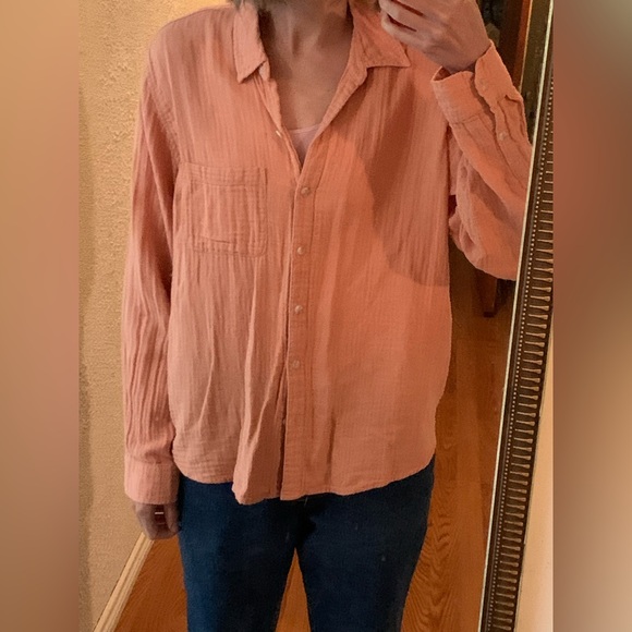 Various Button Tops - Picture 3 of 16